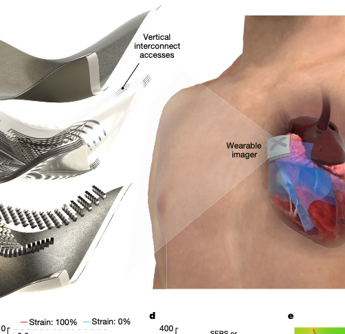 Wearable cardiac imager