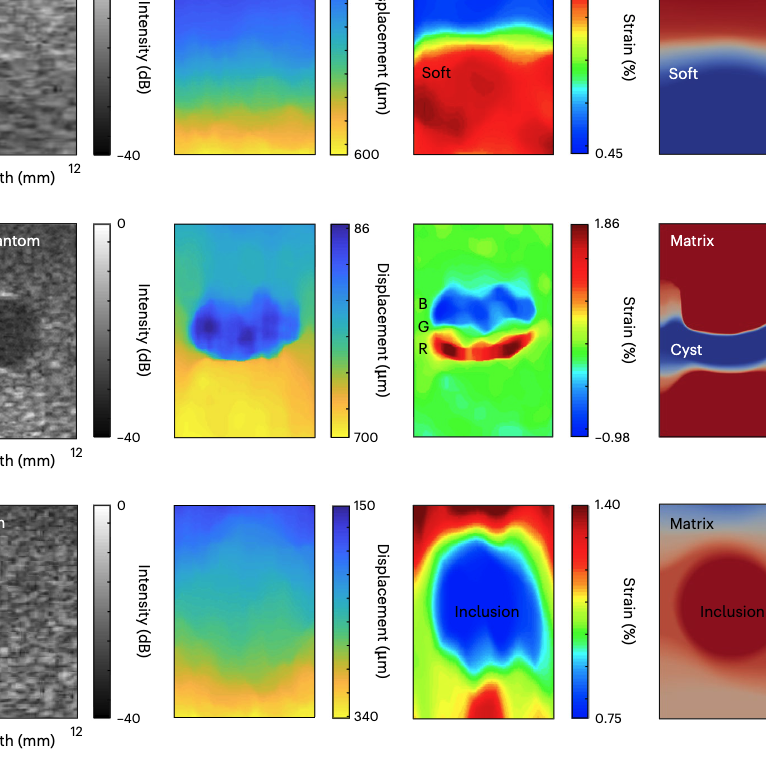 Stretchable ultrasonic arrays